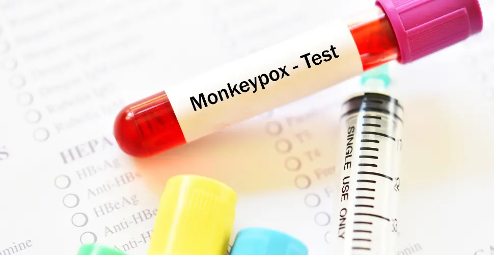 how-to-test-or-monkeypox-3.webp